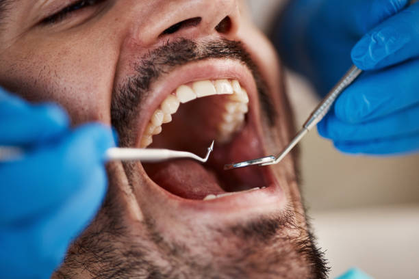 Fast & Reliable Emergency Dental Services in NH